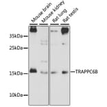Western Blot - Anti-TRAPPC6B Antibody (A88586) - Antibodies.com