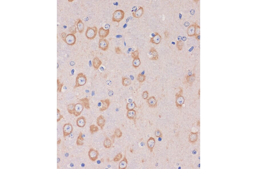 Immunohistochemistry - Anti-TRAPPC6B Antibody (A88586) - Antibodies.com