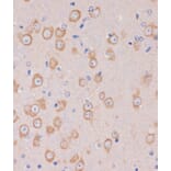 Immunohistochemistry - Anti-TRAPPC6B Antibody (A88586) - Antibodies.com