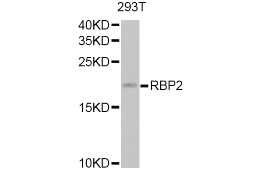 Western Blot - Anti-RBP2 Antibody (A12494) - Antibodies.com