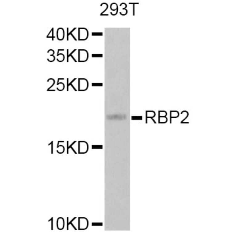 Western Blot - Anti-RBP2 Antibody (A12494) - Antibodies.com