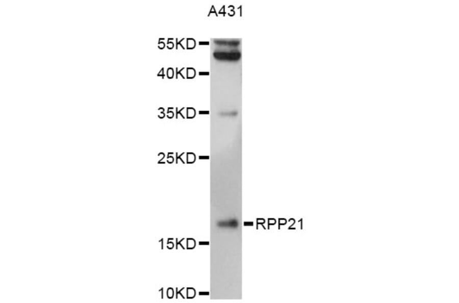 Western Blot - Anti-RPP21 Antibody (A14424) - Antibodies.com