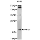 Western Blot - Anti-RPP21 Antibody (A14424) - Antibodies.com