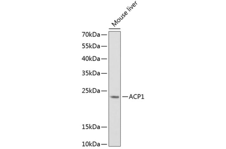 Western Blot - Anti-Acid phosphatase/ACP1 Antibody (A88590) - Antibodies.com