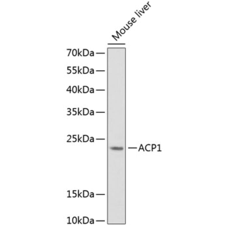 Western Blot - Anti-Acid phosphatase/ACP1 Antibody (A88590) - Antibodies.com