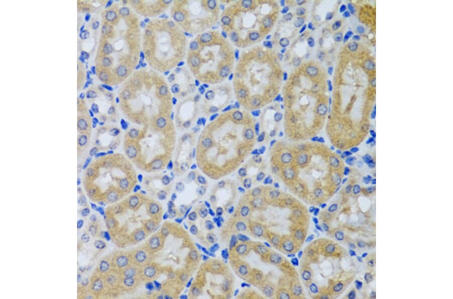 Immunohistochemistry - Anti-Acid phosphatase/ACP1 Antibody (A88590) - Antibodies.com