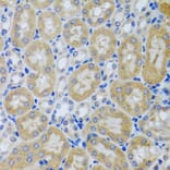 Immunohistochemistry - Anti-Acid phosphatase/ACP1 Antibody (A88590) - Antibodies.com