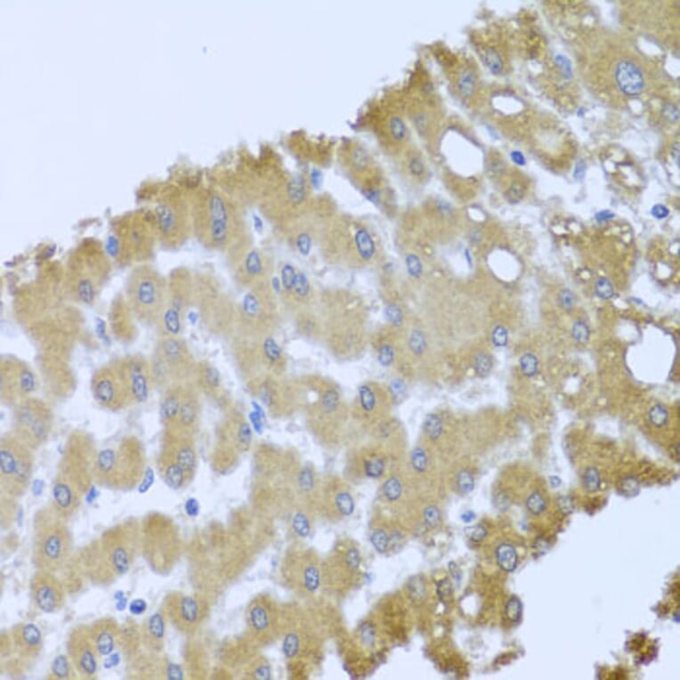 Immunohistochemistry - Anti-Acid phosphatase/ACP1 Antibody (A88590) - Antibodies.com