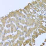 Immunohistochemistry - Anti-Acid phosphatase/ACP1 Antibody (A88590) - Antibodies.com
