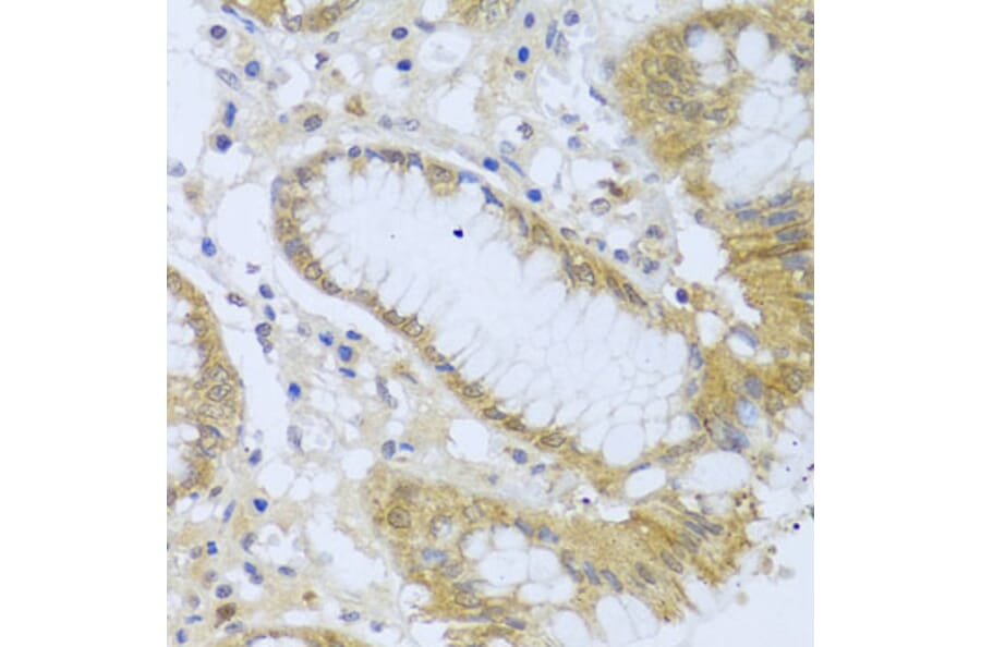 Immunohistochemistry - Anti-Acid phosphatase/ACP1 Antibody (A88590) - Antibodies.com