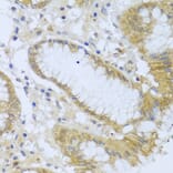Immunohistochemistry - Anti-Acid phosphatase/ACP1 Antibody (A88590) - Antibodies.com