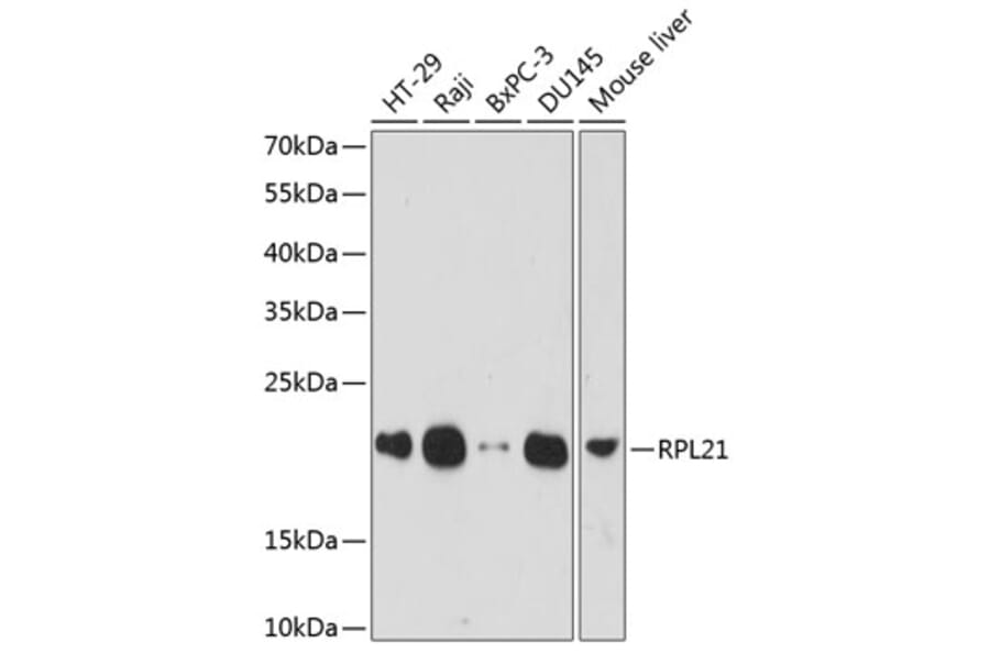 Western Blot - Anti-RPL21 Antibody (A88591) - Antibodies.com