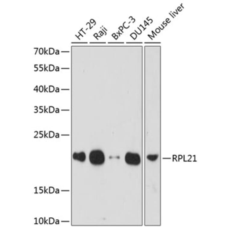 Western Blot - Anti-RPL21 Antibody (A88591) - Antibodies.com