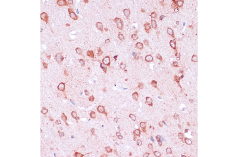 Immunohistochemistry - Anti-RPL21 Antibody (A88591) - Antibodies.com