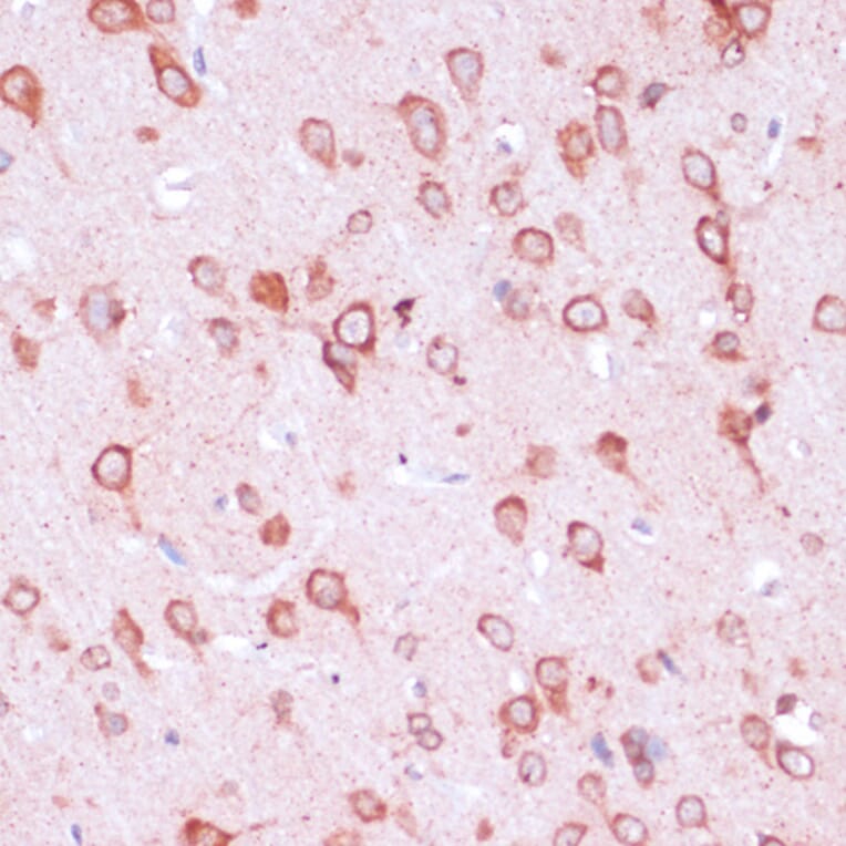 Immunohistochemistry - Anti-RPL21 Antibody (A88591) - Antibodies.com