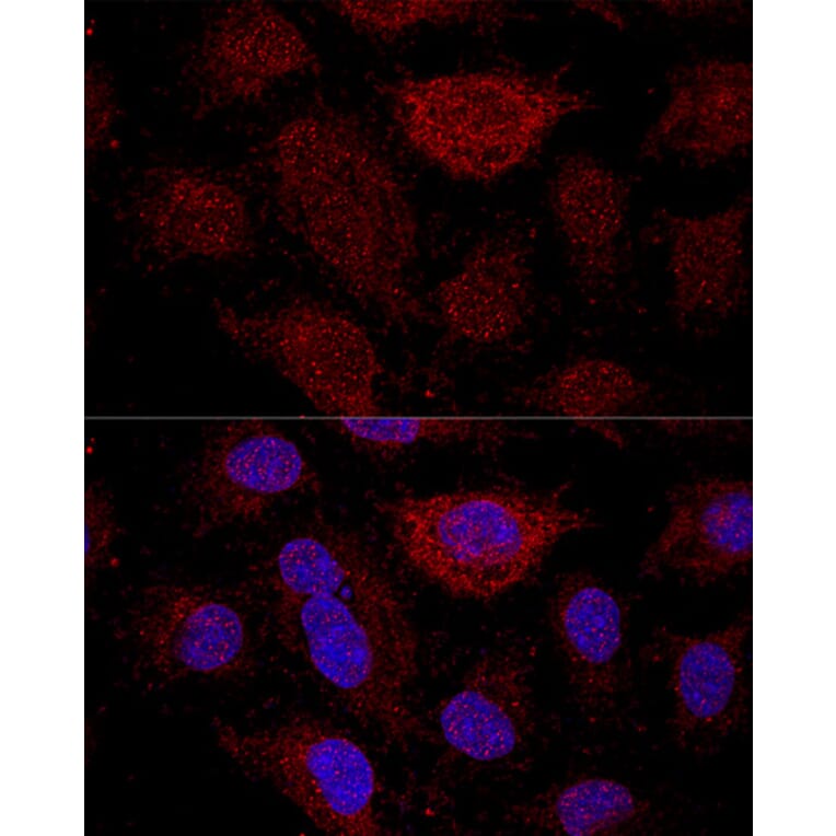 Immunofluorescence - Anti-RPL21 Antibody (A88591) - Antibodies.com