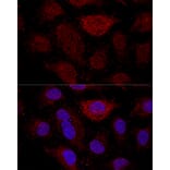 Immunofluorescence - Anti-RPL21 Antibody (A88591) - Antibodies.com