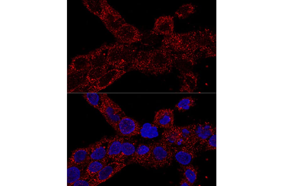 Immunofluorescence - Anti-RPL21 Antibody (A88591) - Antibodies.com