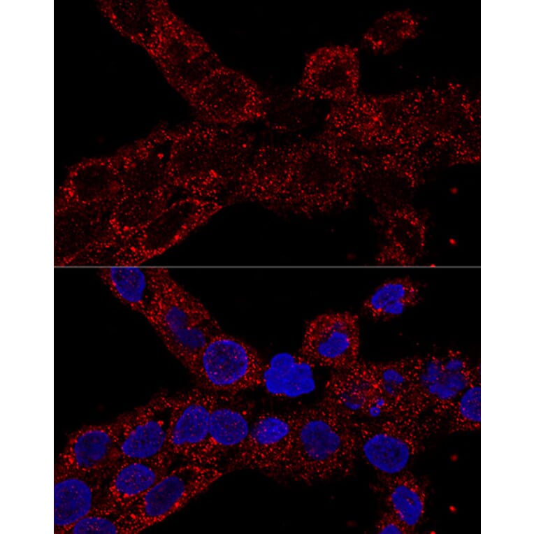 Immunofluorescence - Anti-RPL21 Antibody (A88591) - Antibodies.com