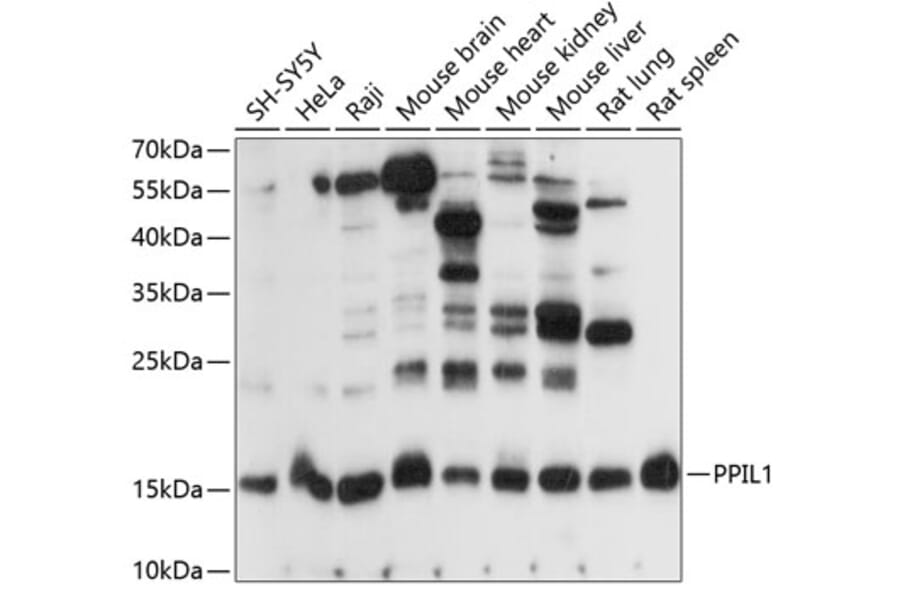 Western Blot - Anti-PPIL1 Antibody (A88593) - Antibodies.com