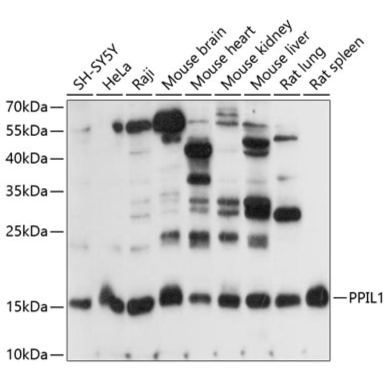 Western Blot - Anti-PPIL1 Antibody (A88593) - Antibodies.com