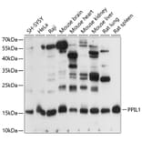 Western Blot - Anti-PPIL1 Antibody (A88593) - Antibodies.com