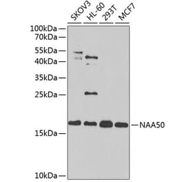 Western Blot - Anti-NAT13 Antibody (A88594) - Antibodies.com