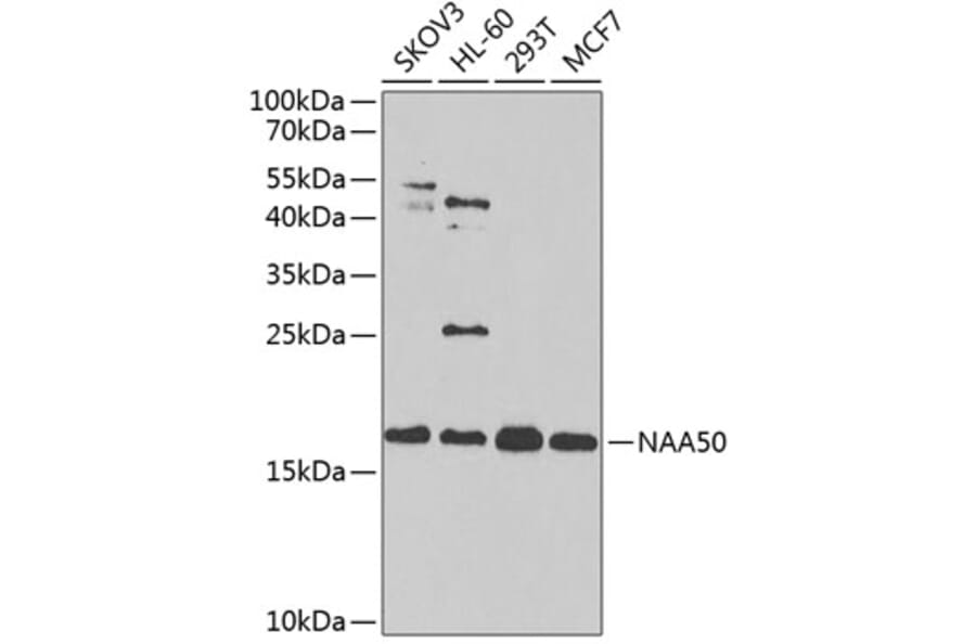 Western Blot - Anti-NAT13 Antibody (A88594) - Antibodies.com