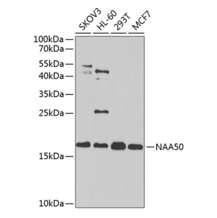 Western Blot - Anti-NAT13 Antibody (A88594) - Antibodies.com