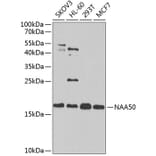 Western Blot - Anti-NAT13 Antibody (A88594) - Antibodies.com