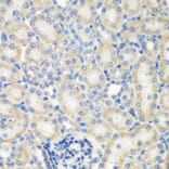 Immunohistochemistry - Anti-NAT13 Antibody (A88594) - Antibodies.com