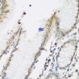 Immunohistochemistry - Anti-NAT13 Antibody (A88594) - Antibodies.com