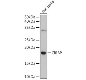 Western Blot - Anti-CIRP Antibody (A88595) - Antibodies.com