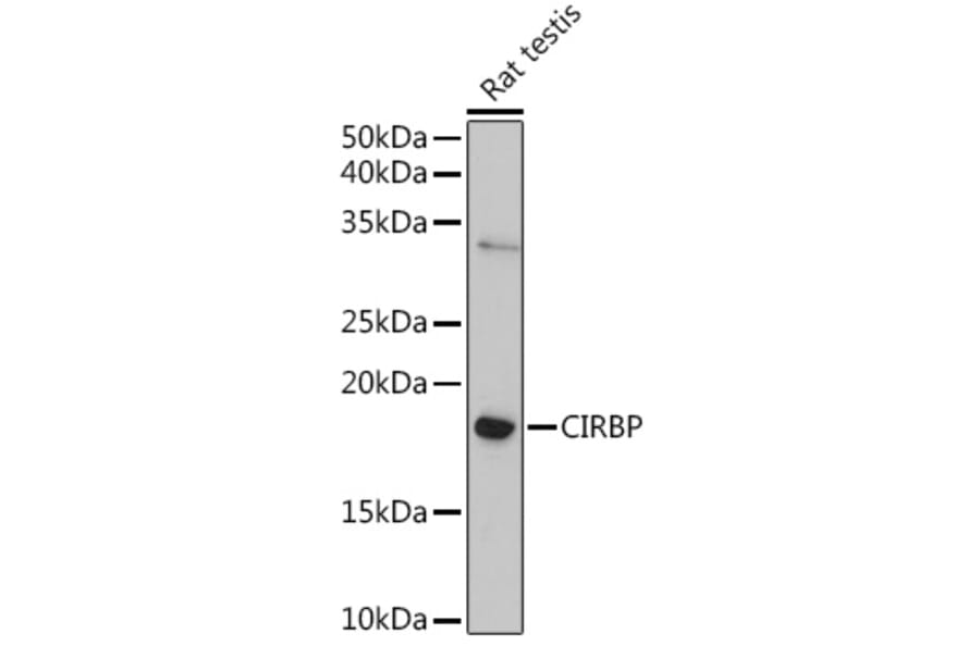 Western Blot - Anti-CIRP Antibody (A88595) - Antibodies.com