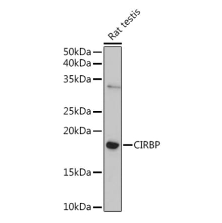 Western Blot - Anti-CIRP Antibody (A88595) - Antibodies.com