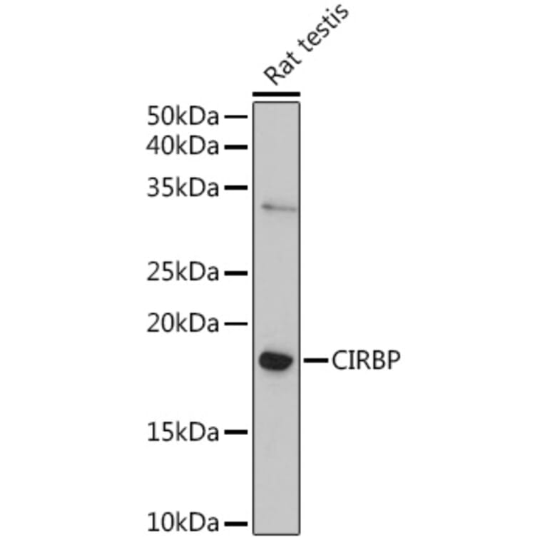 Western Blot - Anti-CIRP Antibody (A88595) - Antibodies.com