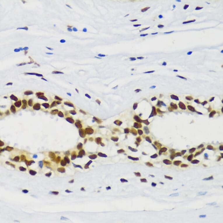 Immunohistochemistry - Anti-CIRP Antibody (A88595) - Antibodies.com