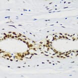 Immunohistochemistry - Anti-CIRP Antibody (A88595) - Antibodies.com