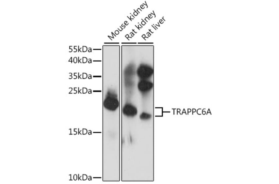 Western Blot - Anti-TRAPPC6A Antibody (A88596) - Antibodies.com