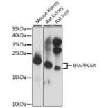 Western Blot - Anti-TRAPPC6A Antibody (A88596) - Antibodies.com