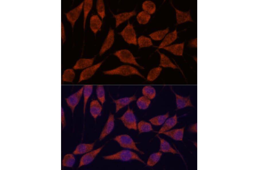 Immunofluorescence - Anti-TRAPPC6A Antibody (A88596) - Antibodies.com
