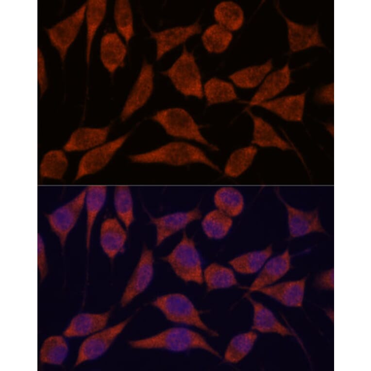 Immunofluorescence - Anti-TRAPPC6A Antibody (A88596) - Antibodies.com