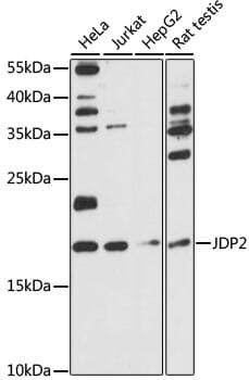Western blot analysis of extracts of various cell lines, using Anti-JDP2 Antibody (A15208) at 1:1,000 dilution.
Secondary antibody: Goat Anti-Rabbit IgG (H+L) (HRP) (AS014) at 1:10,000 dilution.
Lysates / proteins: 25µg per lane.
Blocking buffer: 3% non-fat dry milk in TBST.
Detection: ECL Basic Kit (RM00020).
Exposure time: 90s.