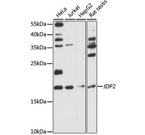 Western Blot - Anti-JDP2 Antibody (A88597) - Antibodies.com