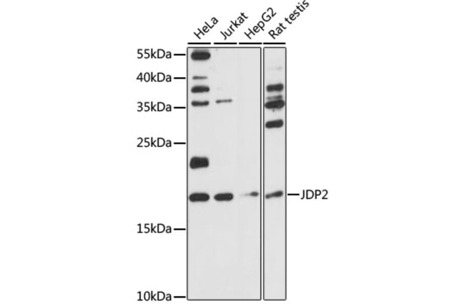 Western Blot - Anti-JDP2 Antibody (A88597) - Antibodies.com