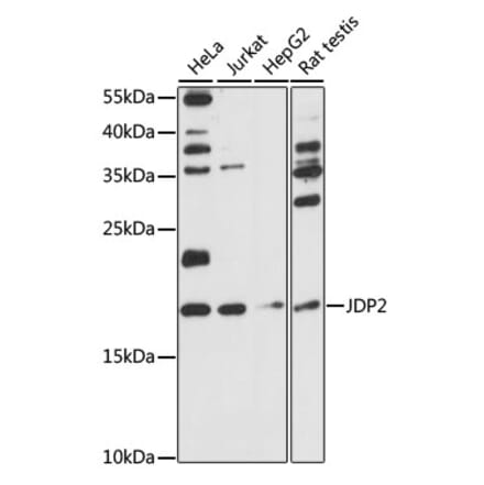 Western Blot - Anti-JDP2 Antibody (A88597) - Antibodies.com
