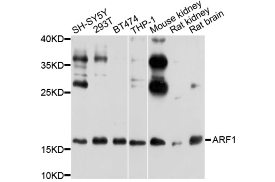 Western Blot - Anti-ARF1 Antibody (A7643) - Antibodies.com