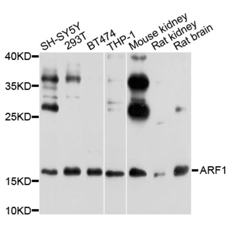 Western Blot - Anti-ARF1 Antibody (A7643) - Antibodies.com