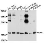 Western Blot - Anti-ARF1 Antibody (A7643) - Antibodies.com