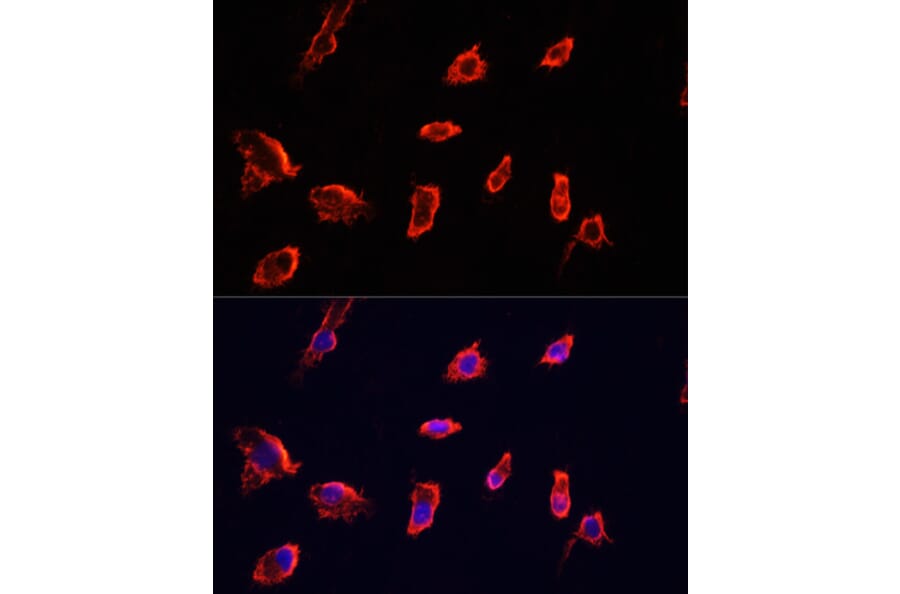 Immunofluorescence - Anti-ARF1 Antibody (A7643) - Antibodies.com